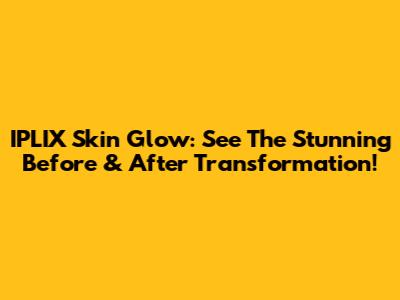 IPLIX Skin Glow: See The Stunning Before & After Transformation!